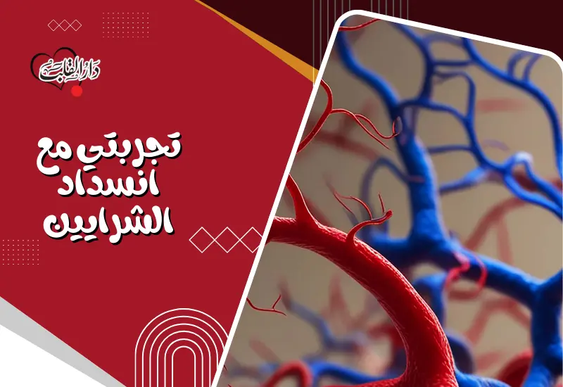 تجربتي-مع-انسداد-الشرايين.webp