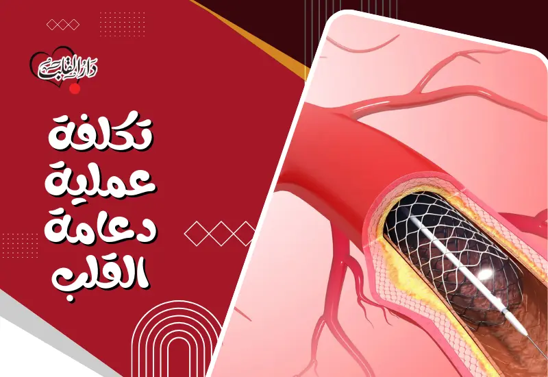 تكلفة-عملية-دعامة-القلب.webp