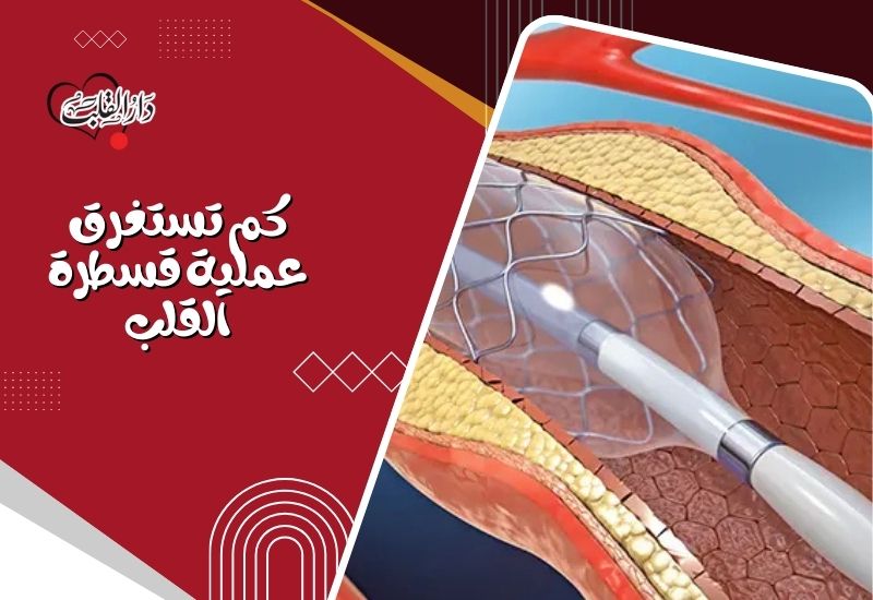 كم-تستغرق-عملية-قسطرة-القلب-1.jpg