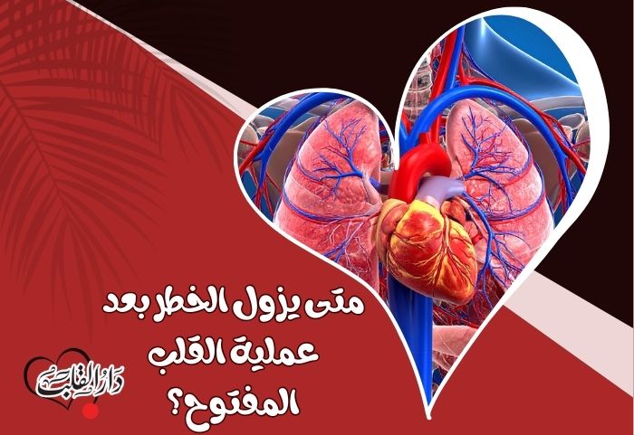 متى يزول الخطر بعد عملية القلب المفتوح؟