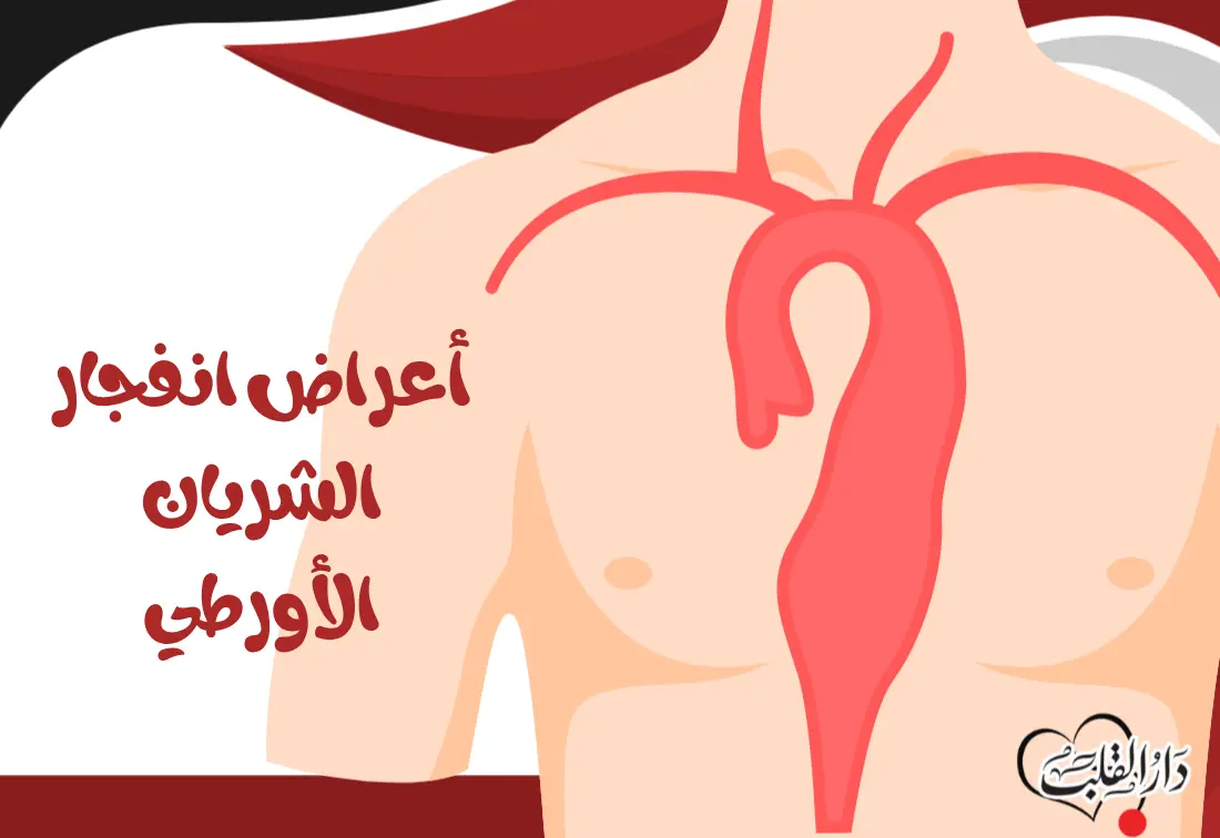 أعراض-انفجار-الشريان-الأورطي.webp