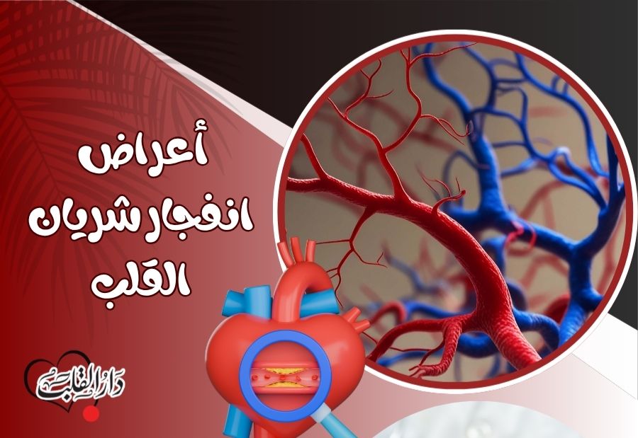 أعراض-انفجار-شريان-القلب.jpg