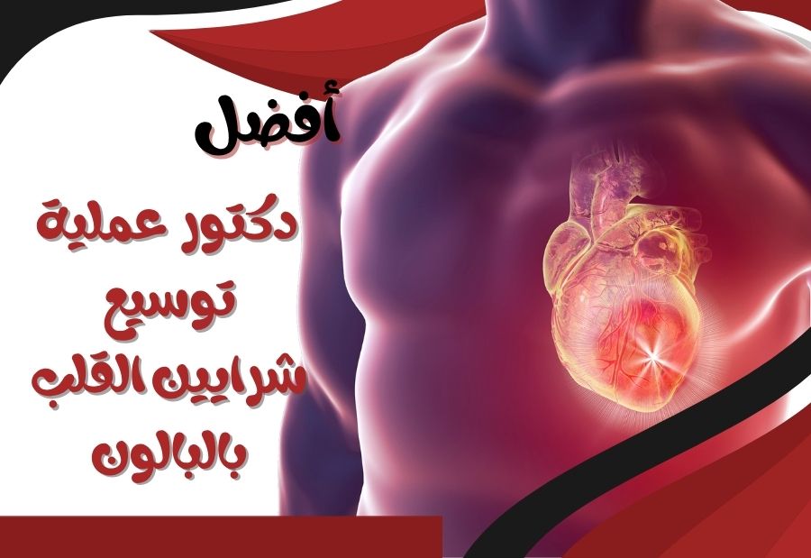 أفضل دكتور لعملية توسيع شرايين القلب بالبالون