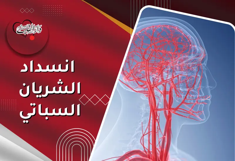 _انسداد الشريان السباتي