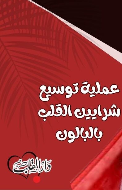 عملية-توسيع-شرايين-القلب-بالبالون-e1783208630577.jpg