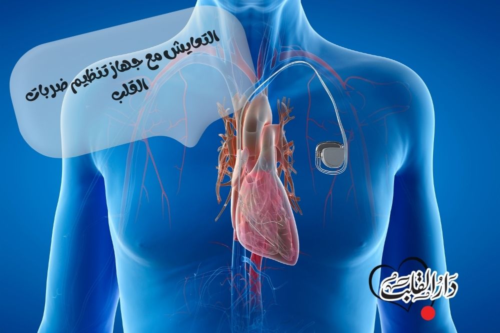التعايش مع جهاز تنظيم ضربات القلب