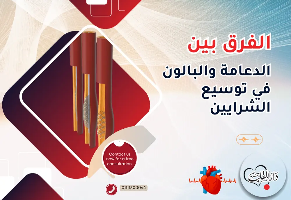 الفرق-بين-الدعامة-والبالون-في-توسيع-الشرايين.webp