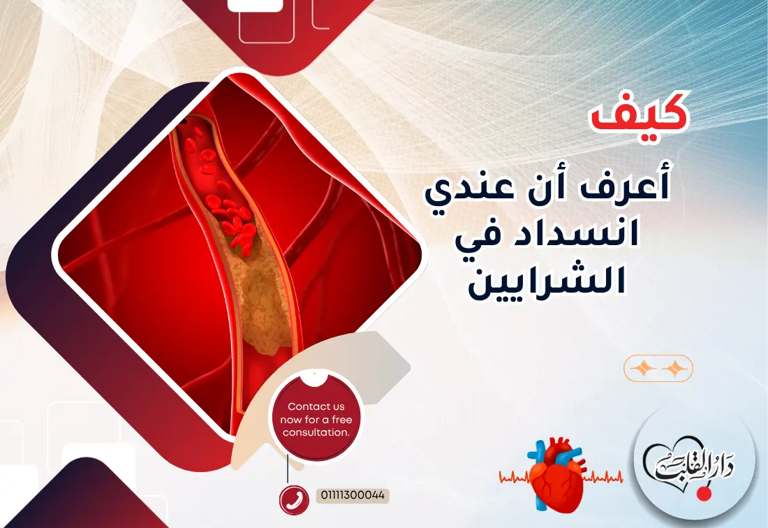 كيف-أعرف-أن-عندي-انسداد-في-الشرايين.webp