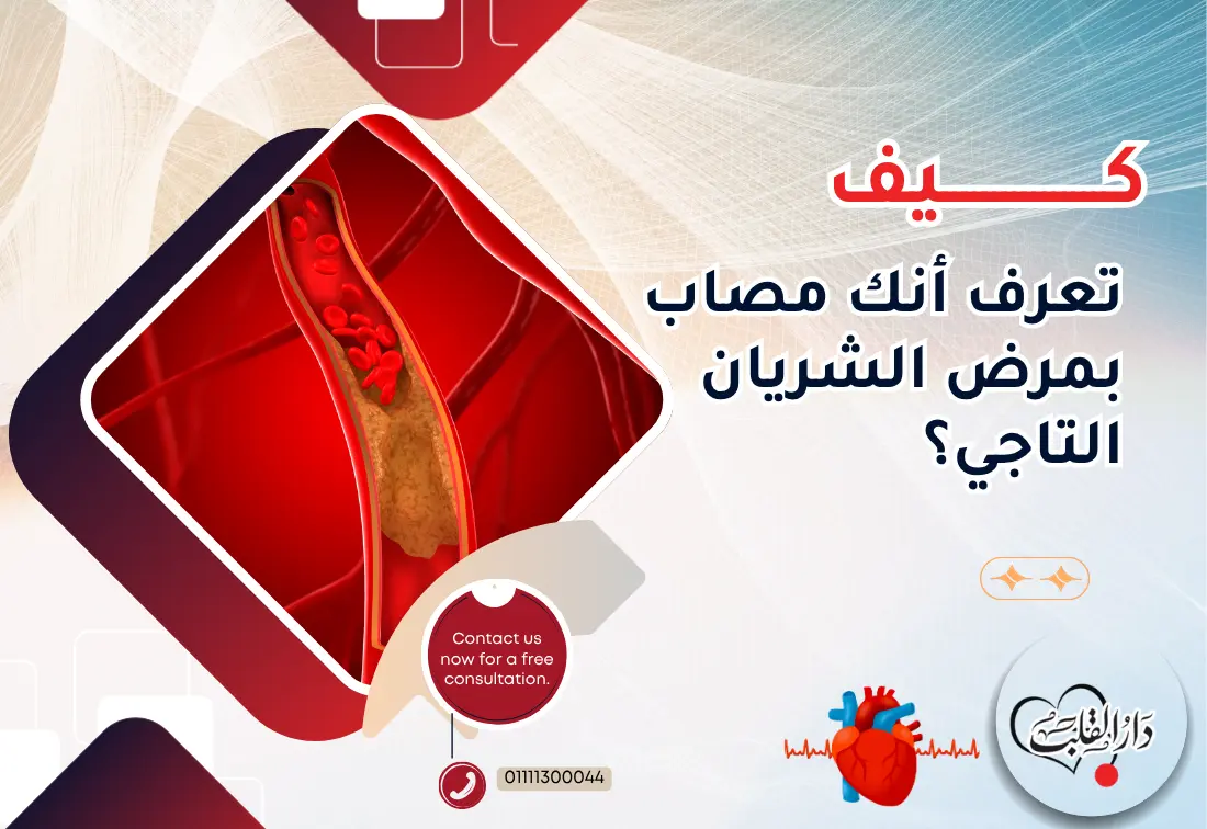 كيف-تعرف-أنك-مصاب-بمرض-الشريان-التاجي؟.webp