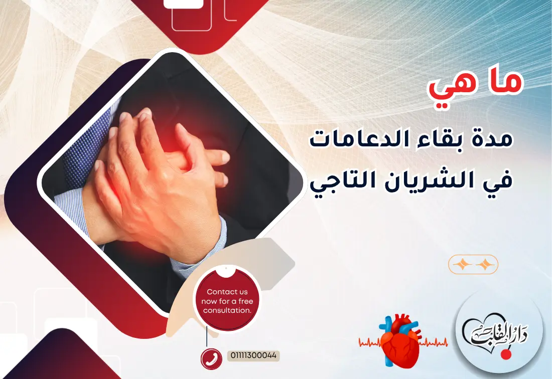 ما-هي-مدة-بقاء-الدعامات-في-الشريان-التاجي.webp