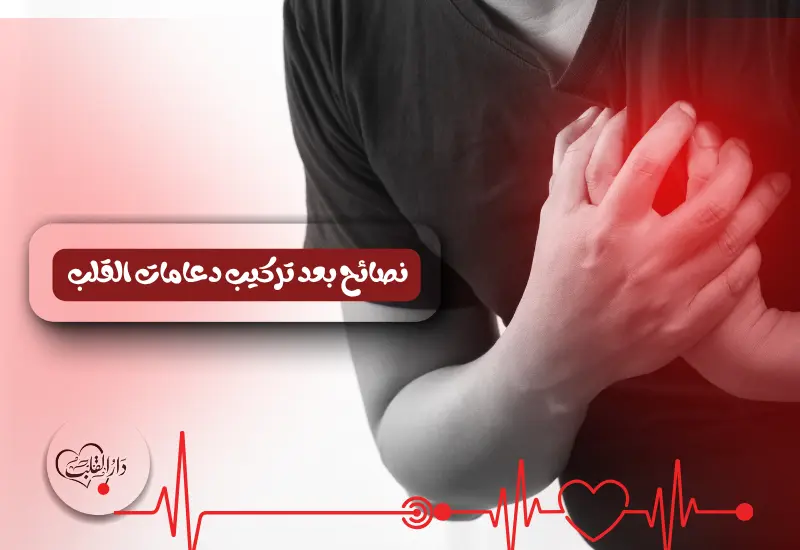 نصائح بعد تركيب دعامات القلب