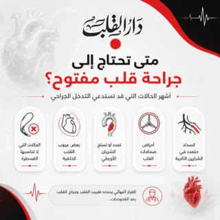  جراحة قلب مفتوح