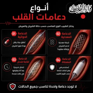 أنواع دعامات القلب